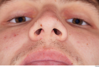 Darren nose 0003.jpg